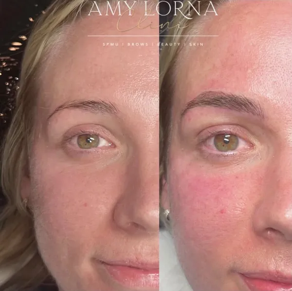 Before and after brows by Amy, client photo 2 of 14