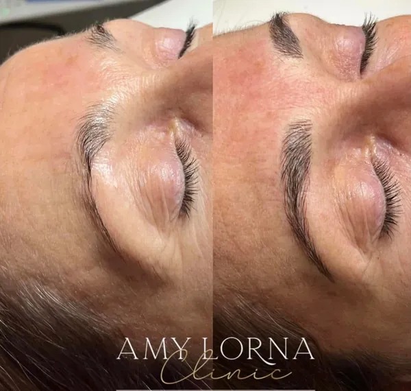 Before and after brows by Amy, client photo 3 of 14